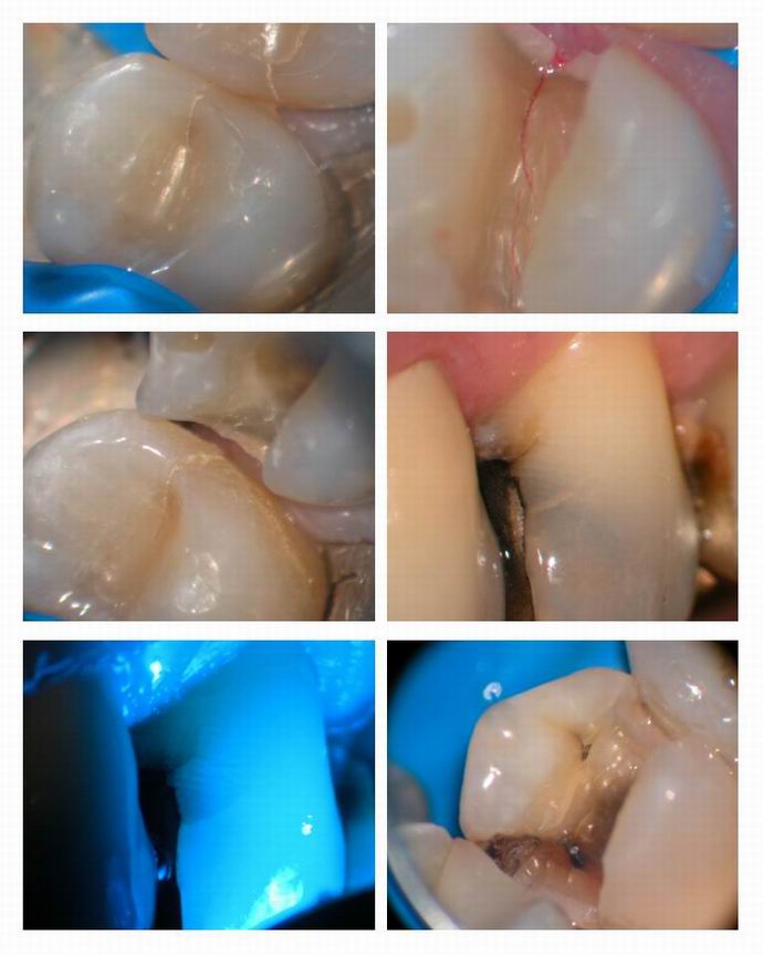 Resize of Cracked teeth pg 1.jpg